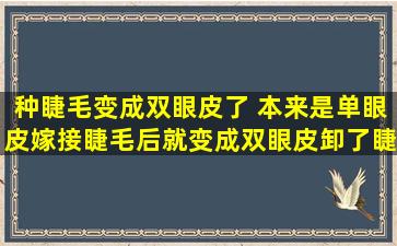 种睫毛变成双眼皮了 本来是单眼皮嫁接睫毛后就变成双眼皮卸了睫毛又成了单